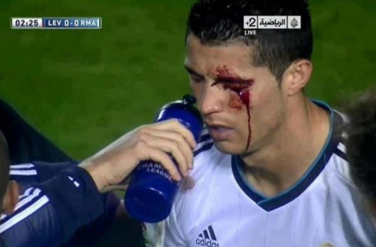 下载入口-莱万特旧将：我过去曾无意肘击C罗，媒体却几乎要把我关进监狱